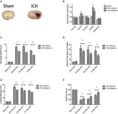 Melatonin Suppresses Microglial Necroptosis by Regulating Deubiquitinating Enzyme A20 After Intracerebral Hemorrhage